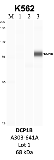 Bethyl_A303-641A_1_DCP1B.png<br>Caption: IP-WB analysis of K562 whole cell lysate using the DCP1B specific antibody, A303-641A. Lanes 1 and 2 are 2.5% of five million whole cell lysate input and 50% of IP enrichment, respectively, using a normal IgG antibody. Lane 3 is 50% of IP enrichment from five million whole cell lysate using the DCP1B-specific antibody, A303-641A. The same antibody was used to detect protein levels via Western blot. This antibody passes preliminary validation and will be further pursued for secondary validation. *NOTE* Protein sizes are taken from Genecards.org and are only estimates based on sequence. Actual protein size may differ based on protein characteristics and electrophoresis method used.