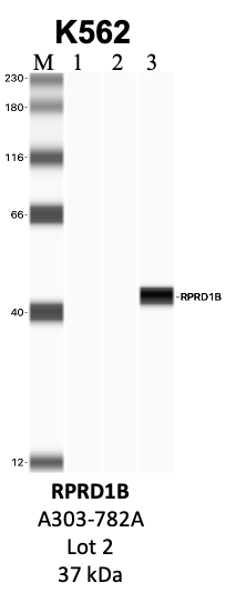 Bethyl_A303-782A_2_RPRD1B.png<br>Caption: IP-WB analysis of K562 whole cell lysate using the RPRD1B specific antibody, A303-782A. Lanes 1 and 2 are 2.5% of five million whole cell lysate input and 50% of IP enrichment, respectively, using a normal IgG antibody. Lane 3 is 50% of IP enrichment from five million whole cell lysate using the RPRD1B-specific antibody, A303-782A. The same antibody was used to detect protein levels via Western blot. This antibody passes preliminary validation and will be further pursued for secondary validation. *NOTE* Protein sizes are taken from Genecards.org and are only estimates based on sequence. Actual protein size may differ based on protein characteristics and electrophoresis method used.