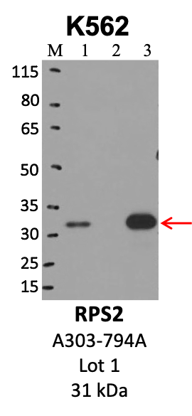 Bethyl_A303-794A_1_RPS2.png<br>Caption: IP-WB analysis of K562 whole cell lysate using the RPS2 specific antibody, A303-794A. Lanes 1 and 2 are 2.5% of five million whole cell lysate input and 50% of IP enrichment, respectively, using a normal IgG antibody. Lane 3 is 50% of IP enrichment from five million whole cell lysate using the RPS2-specific antibody, A303-794A. The same antibody was used to detect protein levels via Western blot. This antibody passes preliminary validation and will be further pursued for secondary validation. *NOTE* Protein sizes are taken from Genecards.org and are only estimates based on sequence. Actual protein size may differ based on protein characteristics and electrophoresis method used.