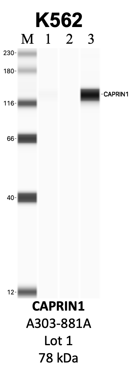 Bethyl_A303-881A_1_CAPRIN1.png<br>Caption: IP-WB analysis of K562 whole cell lysate using the CAPRIN1 specific antibody, A303-881A. Lanes 1 and 2 are 2.5% of five million whole cell lysate input and 50% of IP enrichment, respectively, using a normal IgG antibody. Lane 3 is 50% of IP enrichment from five million whole cell lysate using the CAPRIN1-specific antibody, A303-881A. The same antibody was used to detect protein levels via Western blot. This antibody passes preliminary validation and will be further pursued for secondary validation. *NOTE* Protein sizes are taken from Genecards.org and are only estimates based on sequence. Actual protein size may differ based on protein characteristics and electrophoresis method used.