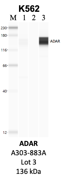 Bethyl_A303-883A_3_ADAR.png<br>Caption: IP-WB analysis of K562 whole cell lysate using the ADAR specific antibody, A303-883A. Lanes 1 and 2 are 2.5% of five million whole cell lysate input and 50% of IP enrichment, respectively, using a normal IgG antibody. Lane 3 is 50% of IP enrichment from five million whole cell lysate using the ADAR-specific antibody, A303-883A. The same antibody was used to detect protein levels via Western blot. This antibody passes preliminary validation and will be further pursued for secondary validation. *NOTE* Protein sizes are taken from Genecards.org and are only estimates based on sequence. Actual protein size may differ based on protein characteristics and electrophoresis method used.