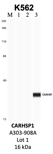 Bethyl_A303-908A_1_CARHSP1.png<br>Caption: IP-WB analysis of K562 whole cell lysate using the CARHSP1 specific antibody, A303-908A. Lanes 1 and 2 are 2.5% of five million whole cell lysate input and 50% of IP enrichment, respectively, using a normal IgG antibody. Lane 3 is 50% of IP enrichment from five million whole cell lysate using the CARHSP1-specific antibody, A303-908A. The same antibody was used to detect protein levels via Western blot. This antibody passes preliminary validation and will be further pursued for secondary validation. *NOTE* Protein sizes are taken from Genecards.org and are only estimates based on sequence. Actual protein size may differ based on protein characteristics and electrophoresis method used.