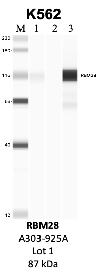 Bethyl_A303-925A_1_RBM28.png<br>Caption: IP-WB analysis of K562 whole cell lysate using the RBM28 specific antibody, A303-925A. Lanes 1 and 2 are 2.5% of five million whole cell lysate input and 50% of IP enrichment, respectively, using a normal IgG antibody. Lane 3 is 50% of IP enrichment from five million whole cell lysate using the RBM28-specific antibody, A303-925A. The same antibody was used to detect protein levels via Western blot. This antibody passes preliminary validation and will be further pursued for secondary validation. *NOTE* Protein sizes are taken from Genecards.org and are only estimates based on sequence. Actual protein size may differ based on protein characteristics and electrophoresis method used.