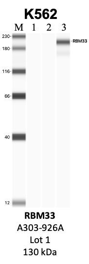 Bethyl_A303-926A_1_RBM33.png<br>Caption: IP-WB analysis of K562 whole cell lysate using the RBM33 specific antibody, A303-926A. Lanes 1 and 2 are 2.5% of five million whole cell lysate input and 50% of IP enrichment, respectively, using a normal IgG antibody. Lane 3 is 50% of IP enrichment from five million whole cell lysate using the RBM33-specific antibody, A303-926A. The same antibody was used to detect protein levels via Western blot. This antibody passes preliminary validation and will be further pursued for secondary validation. *NOTE* Protein sizes are taken from Genecards.org and are only estimates based on sequence. Actual protein size may differ based on protein characteristics and electrophoresis method used.