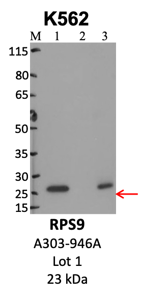 Bethyl_A303-946A_1_RPS9.png<br>Caption: IP-WB analysis of K562 whole cell lysate using the RPS9 specific antibody, A303-946A. Lanes 1 and 2 are 2.5% of five million whole cell lysate input and 50% of IP enrichment, respectively, using a normal IgG antibody. Lane 3 is 50% of IP enrichment from five million whole cell lysate using the RPS9-specific antibody, A303-946A. The same antibody was used to detect protein levels via Western blot. This antibody passes preliminary validation and will be further pursued for secondary validation. *NOTE* Protein sizes are taken from Genecards.org and are only estimates based on sequence. Actual protein size may differ based on protein characteristics and electrophoresis method used.