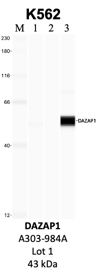 Bethyl_A303-984A_1_DAZAP1.png<br>Caption: IP-WB analysis of K562 whole cell lysate using the DAZAP1 specific antibody, A303-984A. Lanes 1 and 2 are 2.5% of five million whole cell lysate input and 50% of IP enrichment, respectively, using a normal IgG antibody. Lane 3 is 50% of IP enrichment from five million whole cell lysate using the DAZAP1-specific antibody, A303-984A. The same antibody was used to detect protein levels via Western blot. This antibody passes preliminary validation and will be further pursued for secondary validation. *NOTE* Protein sizes are taken from Genecards.org and are only estimates based on sequence. Actual protein size may differ based on protein characteristics and electrophoresis method used.