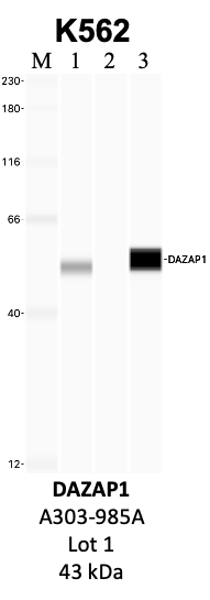 Bethyl_A303-985A_1_DAZAP1.png<br>Caption: IP-WB analysis of K562 whole cell lysate using the DAZAP1 specific antibody, A303-985A. Lanes 1 and 2 are 2.5% of five million whole cell lysate input and 50% of IP enrichment, respectively, using a normal IgG antibody. Lane 3 is 50% of IP enrichment from five million whole cell lysate using the DAZAP1-specific antibody, A303-985A. The same antibody was used to detect protein levels via Western blot. This antibody passes preliminary validation and will be further pursued for secondary validation. *NOTE* Protein sizes are taken from Genecards.org and are only estimates based on sequence. Actual protein size may differ based on protein characteristics and electrophoresis method used.