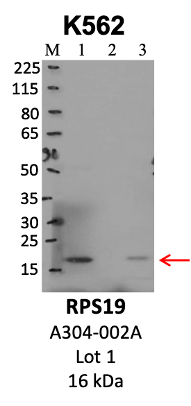 Bethyl_A304-002A_1_RPS19.png<br>Caption: IP-WB analysis of K562 whole cell lysate using the RPS19 specific antibody, A304-002A. Lanes 1 and 2 are 2.5% of five million whole cell lysate input and 50% of IP enrichment, respectively, using a normal IgG antibody. Lane 3 is 50% of IP enrichment from five million whole cell lysate using the RPS19-specific antibody, A304-002A. The same antibody was used to detect protein levels via Western blot. This antibody passes preliminary validation and will be further pursued for secondary validation. *NOTE* Protein sizes are taken from Genecards.org and are only estimates based on sequence. Actual protein size may differ based on protein characteristics and electrophoresis method used.