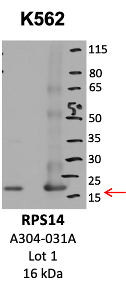 Bethyl_A304-031A_1_RPS14.png<br>Caption: IP-WB analysis of K562 whole cell lysate using the RPS14 specific antibody, A304-031A. Lanes 1 and 2 are 2.5% of five million whole cell lysate input and 50% of IP enrichment, respectively, using a normal IgG antibody. Lane 3 is 50% of IP enrichment from five million whole cell lysate using the RPS14-specific antibody, A304-031A. The same antibody was used to detect protein levels via Western blot. This antibody passes preliminary validation and will be further pursued for secondary validation. *NOTE* Protein sizes are taken from Genecards.org and are only estimates based on sequence. Actual protein size may differ based on protein characteristics and electrophoresis method used.