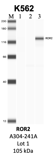 Bethyl_A304-241A_1_ROR2.png<br>Caption: IP-WB analysis of K562 whole cell lysate using the ROR2 specific antibody, A304-241A. Lanes 1 and 2 are 2.5% of five million whole cell lysate input and 50% of IP enrichment, respectively, using a normal IgG antibody. Lane 3 is 50% of IP enrichment from five million whole cell lysate using the ROR2-specific antibody, A304-241A. The same antibody was used to detect protein levels via Western blot. This antibody passes preliminary validation and will be further pursued for secondary validation. *NOTE* Protein sizes are taken from Genecards.org and are only estimates based on sequence. Actual protein size may differ based on protein characteristics and electrophoresis method used.