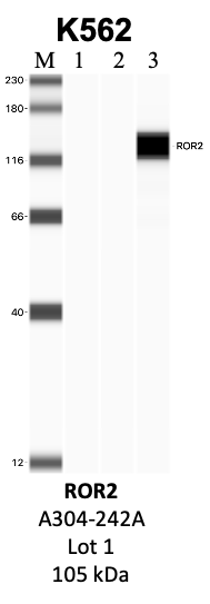 Bethyl_A304-242A_1_ROR2.png<br>Caption: IP-WB analysis of K562 whole cell lysate using the ROR2 specific antibody, A304-242A. Lanes 1 and 2 are 2.5% of five million whole cell lysate input and 50% of IP enrichment, respectively, using a normal IgG antibody. Lane 3 is 50% of IP enrichment from five million whole cell lysate using the ROR2-specific antibody, A304-242A. The same antibody was used to detect protein levels via Western blot. This antibody passes preliminary validation and will be further pursued for secondary validation. *NOTE* Protein sizes are taken from Genecards.org and are only estimates based on sequence. Actual protein size may differ based on protein characteristics and electrophoresis method used.