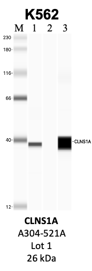 Bethyl_A304-521A_1_CLNS1A.png<br>Caption: IP-WB analysis of K562 whole cell lysate using the CLNS1A specific antibody, A304-521A. Lanes 1 and 2 are 2.5% of five million whole cell lysate input and 50% of IP enrichment, respectively, using a normal IgG antibody. Lane 3 is 50% of IP enrichment from five million whole cell lysate using the CLNS1A-specific antibody, A304-521A. The same antibody was used to detect protein levels via Western blot. This antibody passes preliminary validation and will be further pursued for secondary validation. *NOTE* Protein sizes are taken from Genecards.org and are only estimates based on sequence. Actual protein size may differ based on protein characteristics and electrophoresis method used.