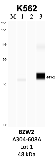 Bethyl_A304-608A_1_BZW2.png<br>Caption: IP-WB analysis of K562 whole cell lysate using the BZW2 specific antibody, A304-608A. Lanes 1 and 2 are 2.5% of five million whole cell lysate input and 50% of IP enrichment, respectively, using a normal IgG antibody. Lane 3 is 50% of IP enrichment from five million whole cell lysate using the BZW2-specific antibody, A304-608A. The same antibody was used to detect protein levels via Western blot. This antibody passes preliminary validation and will be further pursued for secondary validation. *NOTE* Protein sizes are taken from Genecards.org and are only estimates based on sequence. Actual protein size may differ based on protein characteristics and electrophoresis method used.