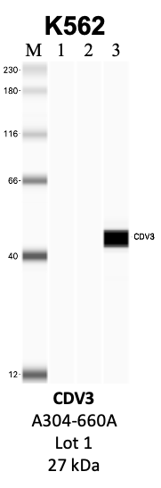 Bethyl_A304-660A_1_CDV3.png<br>Caption: IP-WB analysis of K562 whole cell lysate using the CDV3 specific antibody, A304-660A. Lanes 1 and 2 are 2.5% of five million whole cell lysate input and 50% of IP enrichment, respectively, using a normal IgG antibody. Lane 3 is 50% of IP enrichment from five million whole cell lysate using the CDV3-specific antibody, A304-660A. The same antibody was used to detect protein levels via Western blot. This antibody passes preliminary validation and will be further pursued for secondary validation. *NOTE* Protein sizes are taken from Genecards.org and are only estimates based on sequence. Actual protein size may differ based on protein characteristics and electrophoresis method used.