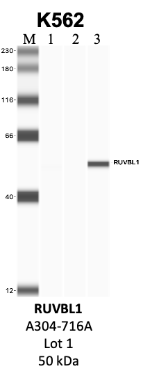 Bethyl_A304-716A_1_RUVBL1.png<br>Caption: IP-WB analysis of K562 whole cell lysate using the RUVBL1 specific antibody, A304-716A. Lanes 1 and 2 are 2.5% of five million whole cell lysate input and 50% of IP enrichment, respectively, using a normal IgG antibody. Lane 3 is 50% of IP enrichment from five million whole cell lysate using the RUVBL1-specific antibody, A304-716A. The same antibody was used to detect protein levels via Western blot. This antibody passes preliminary validation and will be further pursued for secondary validation. *NOTE* Protein sizes are taken from Genecards.org and are only estimates based on sequence. Actual protein size may differ based on protein characteristics and electrophoresis method used.