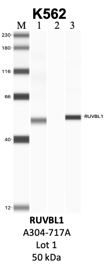 Bethyl_A304-717A_1_RUVBL1.png<br>Caption: IP-WB analysis of K562 whole cell lysate using the RUVBL1 specific antibody, A304-717A. Lanes 1 and 2 are 2.5% of five million whole cell lysate input and 50% of IP enrichment, respectively, using a normal IgG antibody. Lane 3 is 50% of IP enrichment from five million whole cell lysate using the RUVBL1-specific antibody, A304-717A. The same antibody was used to detect protein levels via Western blot. This antibody passes preliminary validation and will be further pursued for secondary validation. *NOTE* Protein sizes are taken from Genecards.org and are only estimates based on sequence. Actual protein size may differ based on protein characteristics and electrophoresis method used.