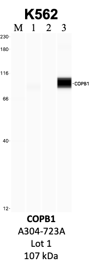 Bethyl_A304-723A_1_COPB1.png<br>Caption: IP-WB analysis of K562 whole cell lysate using the COPB1 specific antibody, A304-723A. Lanes 1 and 2 are 2.5% of five million whole cell lysate input and 50% of IP enrichment, respectively, using a normal IgG antibody. Lane 3 is 50% of IP enrichment from five million whole cell lysate using the COPB1-specific antibody, A304-723A. The same antibody was used to detect protein levels via Western blot. This antibody passes preliminary validation and will be further pursued for secondary validation. *NOTE* Protein sizes are taken from Genecards.org and are only estimates based on sequence. Actual protein size may differ based on protein characteristics and electrophoresis method used.