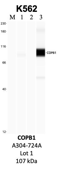 Bethyl_A304-724A_1_COPB1.png<br>Caption: IP-WB analysis of K562 whole cell lysate using the COPB1 specific antibody, A304-724A. Lanes 1 and 2 are 2.5% of five million whole cell lysate input and 50% of IP enrichment, respectively, using a normal IgG antibody. Lane 3 is 50% of IP enrichment from five million whole cell lysate using the COPB1-specific antibody, A304-724A. The same antibody was used to detect protein levels via Western blot. This antibody passes preliminary validation and will be further pursued for secondary validation. *NOTE* Protein sizes are taken from Genecards.org and are only estimates based on sequence. Actual protein size may differ based on protein characteristics and electrophoresis method used.