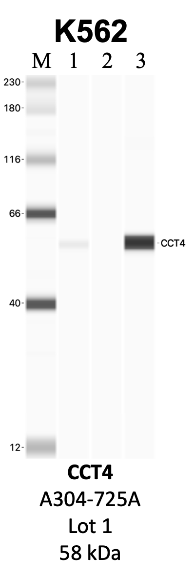 Bethyl_A304-725A_1_CCT4.png<br>Caption: IP-WB analysis of K562 whole cell lysate using the CCT4 specific antibody, A304-725A. Lanes 1 and 2 are 2.5% of five million whole cell lysate input and 50% of IP enrichment, respectively, using a normal IgG antibody. Lane 3 is 50% of IP enrichment from five million whole cell lysate using the CCT4-specific antibody, A304-725A. The same antibody was used to detect protein levels via Western blot. This antibody passes preliminary validation and will be further pursued for secondary validation. *NOTE* Protein sizes are taken from Genecards.org and are only estimates based on sequence. Actual protein size may differ based on protein characteristics and electrophoresis method used.