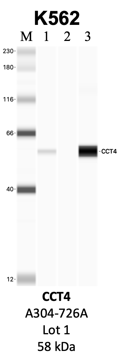 Bethyl_A304-726A_1_CCT4.png<br>Caption: IP-WB analysis of K562 whole cell lysate using the CCT4 specific antibody, A304-726A. Lanes 1 and 2 are 2.5% of five million whole cell lysate input and 50% of IP enrichment, respectively, using a normal IgG antibody. Lane 3 is 50% of IP enrichment from five million whole cell lysate using the CCT4-specific antibody, A304-726A. The same antibody was used to detect protein levels via Western blot. This antibody passes preliminary validation and will be further pursued for secondary validation. *NOTE* Protein sizes are taken from Genecards.org and are only estimates based on sequence. Actual protein size may differ based on protein characteristics and electrophoresis method used.