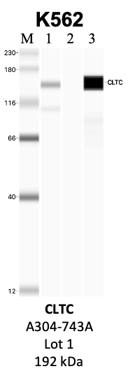 Bethyl_A304-743A_1_CLTC.png<br>Caption: IP-WB analysis of K562 whole cell lysate using the CLTC specific antibody, A304-743A. Lanes 1 and 2 are 2.5% of five million whole cell lysate input and 50% of IP enrichment, respectively, using a normal IgG antibody. Lane 3 is 50% of IP enrichment from five million whole cell lysate using the CLTC-specific antibody, A304-743A. The same antibody was used to detect protein levels via Western blot. This antibody passes preliminary validation and will be further pursued for secondary validation. *NOTE* Protein sizes are taken from Genecards.org and are only estimates based on sequence. Actual protein size may differ based on protein characteristics and electrophoresis method used.