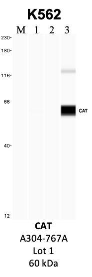 Bethyl_A304-767A_1_CAT.png<br>Caption: IP-WB analysis of K562 whole cell lysate using the CAT specific antibody, A304-767A. Lanes 1 and 2 are 2.5% of five million whole cell lysate input and 50% of IP enrichment, respectively, using a normal IgG antibody. Lane 3 is 50% of IP enrichment from five million whole cell lysate using the CAT-specific antibody, A304-767A. The same antibody was used to detect protein levels via Western blot. This antibody passes preliminary validation and will be further pursued for secondary validation. *NOTE* Protein sizes are taken from Genecards.org and are only estimates based on sequence. Actual protein size may differ based on protein characteristics and electrophoresis method used.