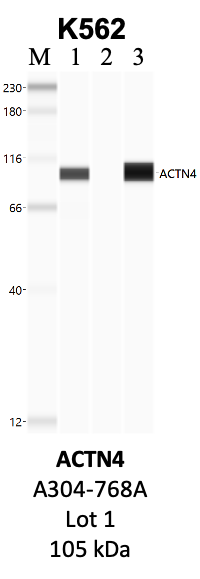 Bethyl_A304-768A_1_ACTN4.png<br>Caption: IP-WB analysis of K562 whole cell lysate using the ACTN4 specific antibody, A304-768A. Lanes 1 and 2 are 2.5% of five million whole cell lysate input and 50% of IP enrichment, respectively, using a normal IgG antibody. Lane 3 is 50% of IP enrichment from five million whole cell lysate using the ACTN4-specific antibody, A304-768A. The same antibody was used to detect protein levels via Western blot. This antibody passes preliminary validation and will be further pursued for secondary validation. *NOTE* Protein sizes are taken from Genecards.org and are only estimates based on sequence. Actual protein size may differ based on protein characteristics and electrophoresis method used.