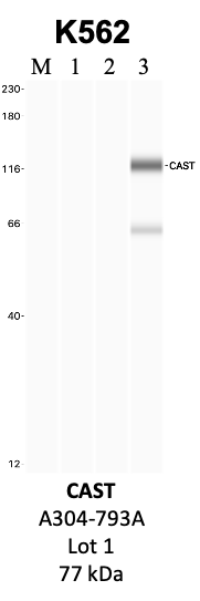 Bethyl_A304-793A_1_CAST.png<br>Caption: IP-WB analysis of K562 whole cell lysate using the CAST specific antibody, A304-793A. Lanes 1 and 2 are 2.5% of five million whole cell lysate input and 50% of IP enrichment, respectively, using a normal IgG antibody. Lane 3 is 50% of IP enrichment from five million whole cell lysate using the CAST-specific antibody, A304-793A. The same antibody was used to detect protein levels via Western blot. This antibody passes preliminary validation and will be further pursued for secondary validation. *NOTE* Protein sizes are taken from Genecards.org and are only estimates based on sequence. Actual protein size may differ based on protein characteristics and electrophoresis method used.