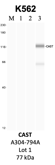 Bethyl_A304-794A_1_CAST.png<br>Caption: IP-WB analysis of K562 whole cell lysate using the CAST specific antibody, A304-794A. Lanes 1 and 2 are 2.5% of five million whole cell lysate input and 50% of IP enrichment, respectively, using a normal IgG antibody. Lane 3 is 50% of IP enrichment from five million whole cell lysate using the CAST-specific antibody, A304-794A. The same antibody was used to detect protein levels via Western blot. This antibody passes preliminary validation and will be further pursued for secondary validation. *NOTE* Protein sizes are taken from Genecards.org and are only estimates based on sequence. Actual protein size may differ based on protein characteristics and electrophoresis method used.