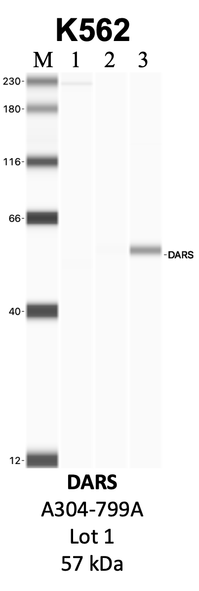 Bethyl_A304-799A_1_DARS.png<br>Caption: IP-WB analysis of K562 whole cell lysate using the DARS specific antibody, A304-799A. Lanes 1 and 2 are 2.5% of five million whole cell lysate input and 50% of IP enrichment, respectively, using a normal IgG antibody. Lane 3 is 50% of IP enrichment from five million whole cell lysate using the DARS-specific antibody, A304-799A. The same antibody was used to detect protein levels via Western blot. This antibody passes preliminary validation and will be further pursued for secondary validation. *NOTE* Protein sizes are taken from Genecards.org and are only estimates based on sequence. Actual protein size may differ based on protein characteristics and electrophoresis method used.