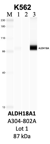 Bethyl_A304-802A_1_ALDH18A1.png<br>Caption: IP-WB analysis of K562 whole cell lysate using the ALDH18A1 specific antibody, A304-802A. Lanes 1 and 2 are 2.5% of five million whole cell lysate input and 50% of IP enrichment, respectively, using a normal IgG antibody. Lane 3 is 50% of IP enrichment from five million whole cell lysate using the ALDH18A1-specific antibody, A304-802A. The same antibody was used to detect protein levels via Western blot. This antibody passes preliminary validation and will be further pursued for secondary validation. *NOTE* Protein sizes are taken from Genecards.org and are only estimates based on sequence. Actual protein size may differ based on protein characteristics and electrophoresis method used.