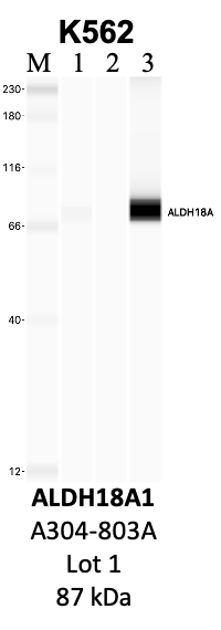 Bethyl_A304-803A_1_ALDH18A1.png<br>Caption: IP-WB analysis of K562 whole cell lysate using the ALDH18A1 specific antibody, A304-803A. Lanes 1 and 2 are 2.5% of five million whole cell lysate input and 50% of IP enrichment, respectively, using a normal IgG antibody. Lane 3 is 50% of IP enrichment from five million whole cell lysate using the ALDH18A1-specific antibody, A304-803A. The same antibody was used to detect protein levels via Western blot. This antibody passes preliminary validation and will be further pursued for secondary validation. *NOTE* Protein sizes are taken from Genecards.org and are only estimates based on sequence. Actual protein size may differ based on protein characteristics and electrophoresis method used.