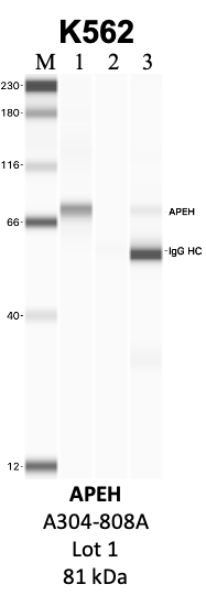 Bethyl_A304-808A_1_APEH.png<br>Caption: IP-WB analysis of K562 whole cell lysate using the APEH specific antibody, A304-808A. Lanes 1 and 2 are 2.5% of five million whole cell lysate input and 50% of IP enrichment, respectively, using a normal IgG antibody. Lane 3 is 50% of IP enrichment from five million whole cell lysate using the APEH-specific antibody, A304-808A. The same antibody was used to detect protein levels via Western blot. This antibody passes preliminary validation and will be further pursued for secondary validation. *NOTE* Protein sizes are taken from Genecards.org and are only estimates based on sequence. Actual protein size may differ based on protein characteristics and electrophoresis method used.