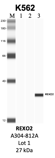 Bethyl_A304-812A_1_REXO2.png<br>Caption: IP-WB analysis of K562 whole cell lysate using the REXO2 specific antibody, A304-812A. Lanes 1 and 2 are 2.5% of five million whole cell lysate input and 50% of IP enrichment, respectively, using a normal IgG antibody. Lane 3 is 50% of IP enrichment from five million whole cell lysate using the REXO2-specific antibody, A304-812A. The same antibody was used to detect protein levels via Western blot. This antibody passes preliminary validation and will be further pursued for secondary validation. *NOTE* Protein sizes are taken from Genecards.org and are only estimates based on sequence. Actual protein size may differ based on protein characteristics and electrophoresis method used.