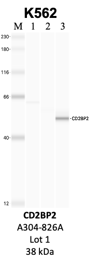 Bethyl_A304-826A_1_CD2BP2.png<br>Caption: IP-WB analysis of K562 whole cell lysate using the CD2BP2 specific antibody, A304-826A. Lanes 1 and 2 are 2.5% of five million whole cell lysate input and 50% of IP enrichment, respectively, using a normal IgG antibody. Lane 3 is 50% of IP enrichment from five million whole cell lysate using the CD2BP2-specific antibody, A304-826A. The same antibody was used to detect protein levels via Western blot. This antibody passes preliminary validation and will be further pursued for secondary validation. *NOTE* Protein sizes are taken from Genecards.org and are only estimates based on sequence. Actual protein size may differ based on protein characteristics and electrophoresis method used.