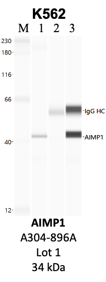 Bethyl_A304-896A_1_AIMP1.png<br>Caption: IP-WB analysis of K562 whole cell lysate using the AIMP1 specific antibody, A304-896A. Lanes 1 and 2 are 2.5% of five million whole cell lysate input and 50% of IP enrichment, respectively, using a normal IgG antibody. Lane 3 is 50% of IP enrichment from five million whole cell lysate using the AIMP1-specific antibody, A304-896A. The same antibody was used to detect protein levels via Western blot. This antibody passes preliminary validation and will be further pursued for secondary validation. *NOTE* Protein sizes are taken from Genecards.org and are only estimates based on sequence. Actual protein size may differ based on protein characteristics and electrophoresis method used.