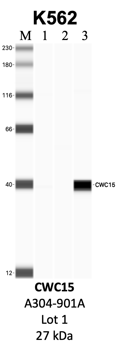 Bethyl_A304-901A_1_CWC15.png<br>Caption: IP-WB analysis of K562 whole cell lysate using the CWC15 specific antibody, A304-900A. Lanes 1 and 2 are 2.5% of five million whole cell lysate input and 50% of IP enrichment, respectively, using a normal IgG antibody. Lane 3 is 50% of IP enrichment from five million whole cell lysate using the CWC15-specific antibody, A304-900A. The same antibody was used to detect protein levels via Western blot. This antibody passes preliminary validation and will be further pursued for secondary validation. *NOTE* Protein sizes are taken from Genecards.org and are only estimates based on sequence. Actual protein size may differ based on protein characteristics and electrophoresis method used.