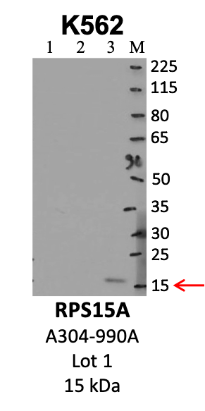 Bethyl_A304-990A_1_RPS15A.png<br>Caption: IP-WB analysis of K562 whole cell lysate using the RPS15A specific antibody, A304-990A. Lanes 1 and 2 are 2.5% of five million whole cell lysate input and 50% of IP enrichment, respectively, using a normal IgG antibody. Lane 3 is 50% of IP enrichment from five million whole cell lysate using the RPS15A-specific antibody, A304-990A. The same antibody was used to detect protein levels via Western blot. This antibody passes preliminary validation and will be further pursued for secondary validation. *NOTE* Protein sizes are taken from Genecards.org and are only estimates based on sequence. Actual protein size may differ based on protein characteristics and electrophoresis method used.