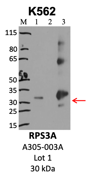 Bethyl_A305-003A_1_RPS3A.png<br>Caption: IP-WB analysis of K562 whole cell lysate using the RPS3A specific antibody, A305-003A. Lanes 1 and 2 are 2.5% of five million whole cell lysate input and 50% of IP enrichment, respectively, using a normal IgG antibody. Lane 3 is 50% of IP enrichment from five million whole cell lysate using the RPS3A-specific antibody, A305-003A. The same antibody was used to detect protein levels via Western blot. This antibody passes preliminary validation and will be further pursued for secondary validation. *NOTE* Protein sizes are taken from Genecards.org and are only estimates based on sequence. Actual protein size may differ based on protein characteristics and electrophoresis method used.