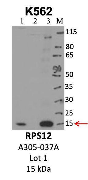 Bethyl_A305-037A_1_RPS12.png<br>Caption: IP-WB analysis of K562 whole cell lysate using the RPS12 specific antibody, A305-037A. Lanes 1 and 2 are 2.5% of five million whole cell lysate input and 50% of IP enrichment, respectively, using a normal IgG antibody. Lane 3 is 50% of IP enrichment from five million whole cell lysate using the RPS12-specific antibody, A305-037A. The same antibody was used to detect protein levels via Western blot. This antibody passes preliminary validation and will be further pursued for secondary validation. *NOTE* Protein sizes are taken from Genecards.org and are only estimates based on sequence. Actual protein size may differ based on protein characteristics and electrophoresis method used.