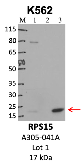 Bethyl_A305-041A_1_RPS15.png<br>Caption: IP-WB analysis of K562 whole cell lysate using the RPS15 specific antibody, A305-041A. Lanes 1 and 2 are 2.5% of five million whole cell lysate input and 50% of IP enrichment, respectively, using a normal IgG antibody. Lane 3 is 50% of IP enrichment from five million whole cell lysate using the RPS15-specific antibody, A305-041A. The same antibody was used to detect protein levels via Western blot. This antibody passes preliminary validation and will be further pursued for secondary validation. *NOTE* Protein sizes are taken from Genecards.org and are only estimates based on sequence. Actual protein size may differ based on protein characteristics and electrophoresis method used.