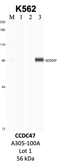 Bethyl_A305-100A_1_CCDC47.png<br>Caption: IP-WB analysis of K562 whole cell lysate using the CCDC47 specific antibody, A305-100A. Lanes 1 and 2 are 2.5% of five million whole cell lysate input and 50% of IP enrichment, respectively, using a normal IgG antibody. Lane 3 is 50% of IP enrichment from five million whole cell lysate using the CCDC47-specific antibody, A305-100A. The same antibody was used to detect protein levels via Western blot. This antibody passes preliminary validation and will be further pursued for secondary validation. *NOTE* Protein sizes are taken from Genecards.org and are only estimates based on sequence. Actual protein size may differ based on protein characteristics and electrophoresis method used.