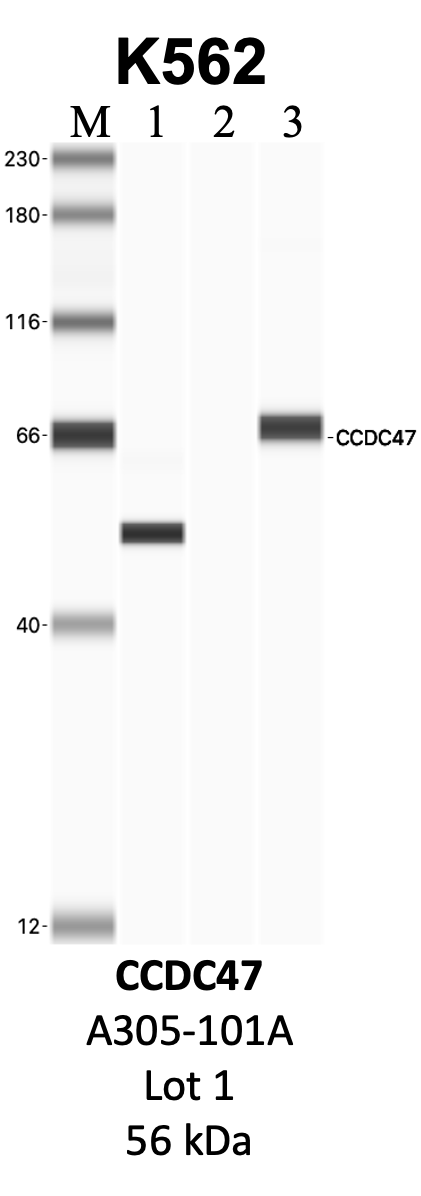 Bethyl_A305-101A_1_CCDC47.png<br>Caption: IP-WB analysis of K562 whole cell lysate using the CCDC47 specific antibody, A305-101A. Lanes 1 and 2 are 2.5% of five million whole cell lysate input and 50% of IP enrichment, respectively, using a normal IgG antibody. Lane 3 is 50% of IP enrichment from five million whole cell lysate using the CCDC47-specific antibody, A305-101A. The same antibody was used to detect protein levels via Western blot. This antibody passes preliminary validation and will be further pursued for secondary validation. *NOTE* Protein sizes are taken from Genecards.org and are only estimates based on sequence. Actual protein size may differ based on protein characteristics and electrophoresis method used.