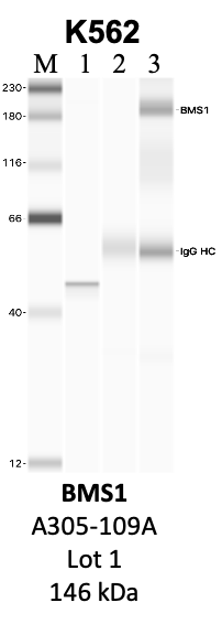 Bethyl_A305-109A_1_BMS1.png<br>Caption: IP-WB analysis of K562 whole cell lysate using the BMS1 specific antibody, A305-109A. Lanes 1 and 2 are 2.5% of five million whole cell lysate input and 50% of IP enrichment, respectively, using a normal IgG antibody. Lane 3 is 50% of IP enrichment from five million whole cell lysate using the BMS1-specific antibody, A305-109A. The same antibody was used to detect protein levels via Western blot. This antibody passes preliminary validation and will be further pursued for secondary validation. *NOTE* Protein sizes are taken from Genecards.org and are only estimates based on sequence. Actual protein size may differ based on protein characteristics and electrophoresis method used.