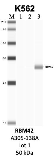 Bethyl_A305-138A_1_RBM42.png<br>Caption: IP-WB analysis of K562 whole cell lysate using the RBM42 specific antibody, A305-138A. Lanes 1 and 2 are 2.5% of five million whole cell lysate input and 50% of IP enrichment, respectively, using a normal IgG antibody. Lane 3 is 50% of IP enrichment from five million whole cell lysate using the RBM42-specific antibody, A305-138A. The same antibody was used to detect protein levels via Western blot. This antibody passes preliminary validation and will be further pursued for secondary validation. *NOTE* Protein sizes are taken from Genecards.org and are only estimates based on sequence. Actual protein size may differ based on protein characteristics and electrophoresis method used.