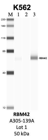 Bethyl_A305-139A_1_RBM42.png<br>Caption: IP-WB analysis of K562 whole cell lysate using the RBM42 specific antibody, A305-139A. Lanes 1 and 2 are 2.5% of five million whole cell lysate input and 50% of IP enrichment, respectively, using a normal IgG antibody. Lane 3 is 50% of IP enrichment from five million whole cell lysate using the RBM42-specific antibody, A305-139A. The same antibody was used to detect protein levels via Western blot. This antibody passes preliminary validation and will be further pursued for secondary validation. *NOTE* Protein sizes are taken from Genecards.org and are only estimates based on sequence. Actual protein size may differ based on protein characteristics and electrophoresis method used.