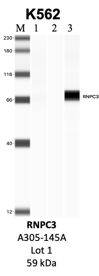 Bethyl_A305-145A_1_RNPC3.png<br>Caption: IP-WB analysis of K562 whole cell lysate using the RNPC3 specific antibody, A305-145A. Lanes 1 and 2 are 2.5% of five million whole cell lysate input and 50% of IP enrichment, respectively, using a normal IgG antibody. Lane 3 is 50% of IP enrichment from five million whole cell lysate using the RNPC3-specific antibody, A305-145A. The same antibody was used to detect protein levels via Western blot. This antibody passes preliminary validation and will be further pursued for secondary validation. *NOTE* Protein sizes are taken from Genecards.org and are only estimates based on sequence. Actual protein size may differ based on protein characteristics and electrophoresis method used.