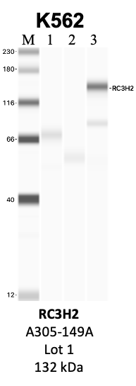 Bethyl_A305-149A_1_RC3H2.png<br>Caption: IP-WB analysis of K562 whole cell lysate using the RC3H2 specific antibody, A305-149A. Lanes 1 and 2 are 2.5% of five million whole cell lysate input and 50% of IP enrichment, respectively, using a normal IgG antibody. Lane 3 is 50% of IP enrichment from five million whole cell lysate using the RC3H2-specific antibody, A305-149A. The same antibody was used to detect protein levels via Western blot. This antibody passes preliminary validation and will be further pursued for secondary validation. *NOTE* Protein sizes are taken from Genecards.org and are only estimates based on sequence. Actual protein size may differ based on protein characteristics and electrophoresis method used.