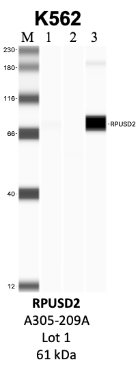 Bethyl_A305-209A_1_RPUSD2.png<br>Caption: IP-WB analysis of K562 whole cell lysate using the RPUSD2 specific antibody, A305-209A. Lanes 1 and 2 are 2.5% of five million whole cell lysate input and 50% of IP enrichment, respectively, using a normal IgG antibody. Lane 3 is 50% of IP enrichment from five million whole cell lysate using the RPUSD2-specific antibody, A305-209A. The same antibody was used to detect protein levels via Western blot. This antibody passes preliminary validation and will be further pursued for secondary validation. *NOTE* Protein sizes are taken from Genecards.org and are only estimates based on sequence. Actual protein size may differ based on protein characteristics and electrophoresis method used.