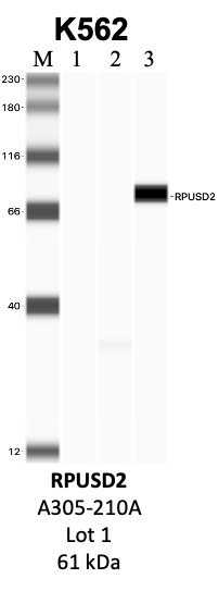 Bethyl_A305-210A_1_RPUSD2.png<br>Caption: IP-WB analysis of K562 whole cell lysate using the RPUSD2 specific antibody, A305-210A. Lanes 1 and 2 are 2.5% of five million whole cell lysate input and 50% of IP enrichment, respectively, using a normal IgG antibody. Lane 3 is 50% of IP enrichment from five million whole cell lysate using the RPUSD2-specific antibody, A305-210A. The same antibody was used to detect protein levels via Western blot. This antibody passes preliminary validation and will be further pursued for secondary validation. *NOTE* Protein sizes are taken from Genecards.org and are only estimates based on sequence. Actual protein size may differ based on protein characteristics and electrophoresis method used.